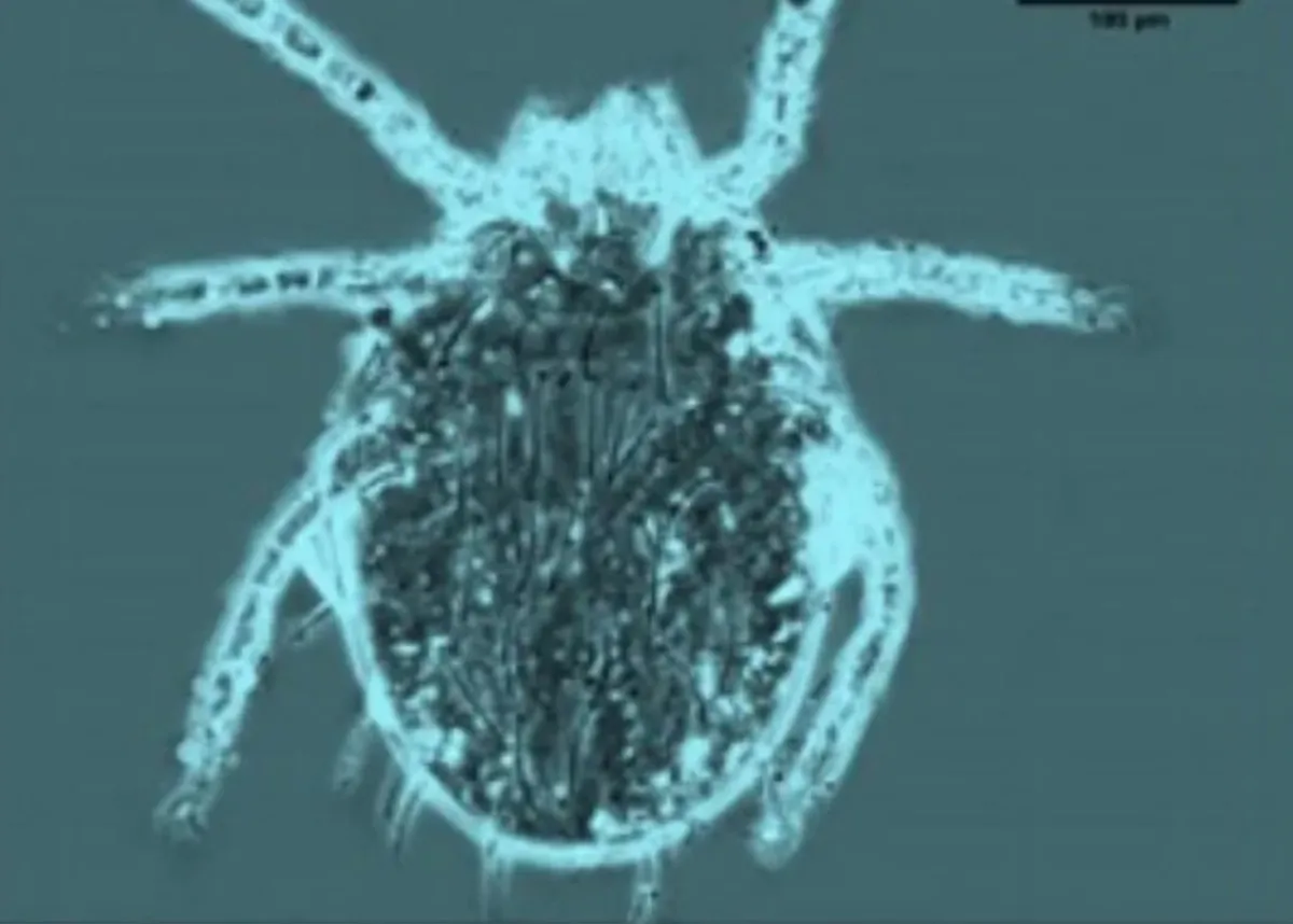 恙蟲病襲台  「這月份」達高峰